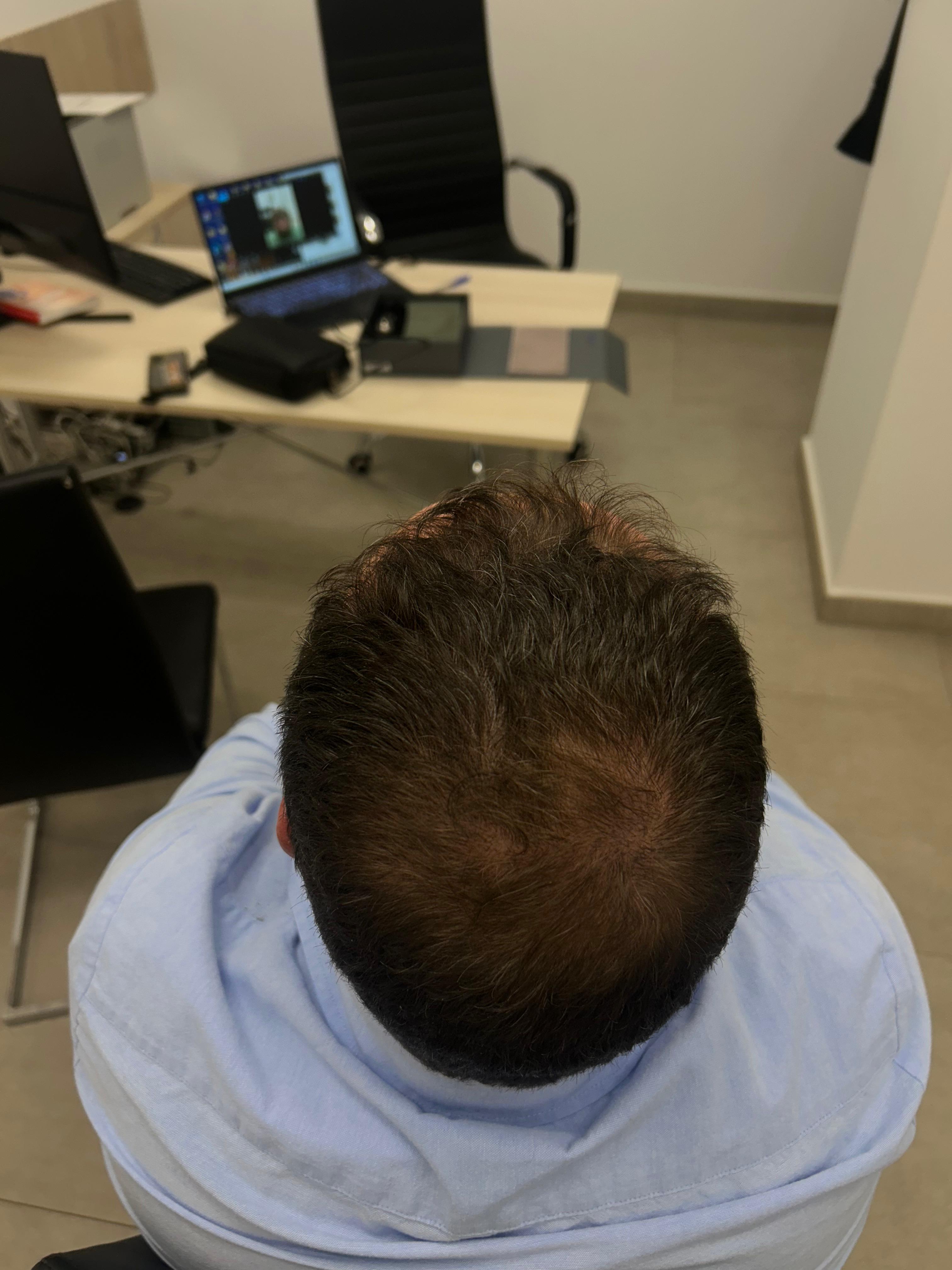 Después del tratamiento · Caso 3